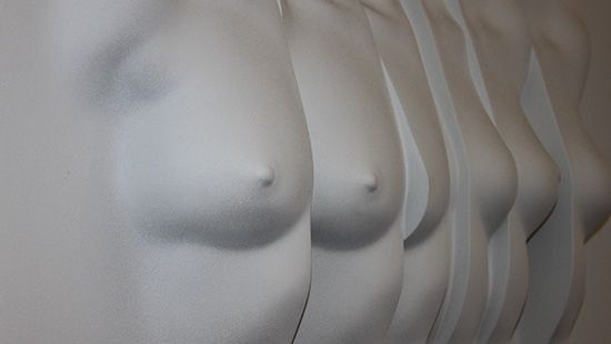 Augmentation mammaire à Vichy | Dr Rogissart