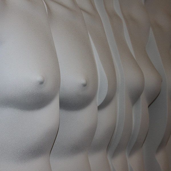 Augmentation des seins par prothèses mammaires à Vichy | Dr Rogissart