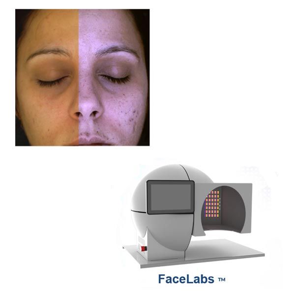 La cabine FaceLabs pour le diagnostic du visage à Vichy | Dr Rogissart